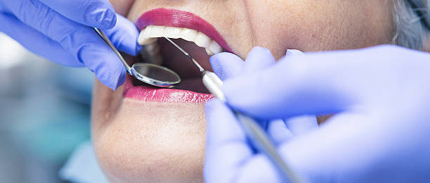 Best Urgent Care for Lost Fillings or Crowns in North Richland Hills, TX