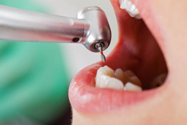 Best After-Hours Dental Trauma Care in North Richland Hills, TX